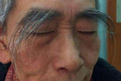 眉毛浓密，则肾气充足，身体强壮 
